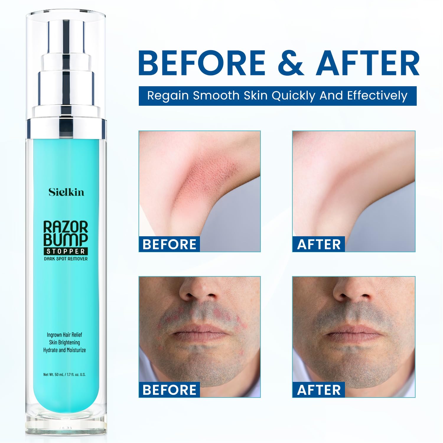 sielkin razor bump stopper ingrown hair aftershave lotion sielkin razor bump stopper ingrown hair aftershave lotion